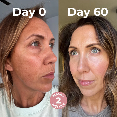 3D Lifting Face Mask for Firming & Brightening