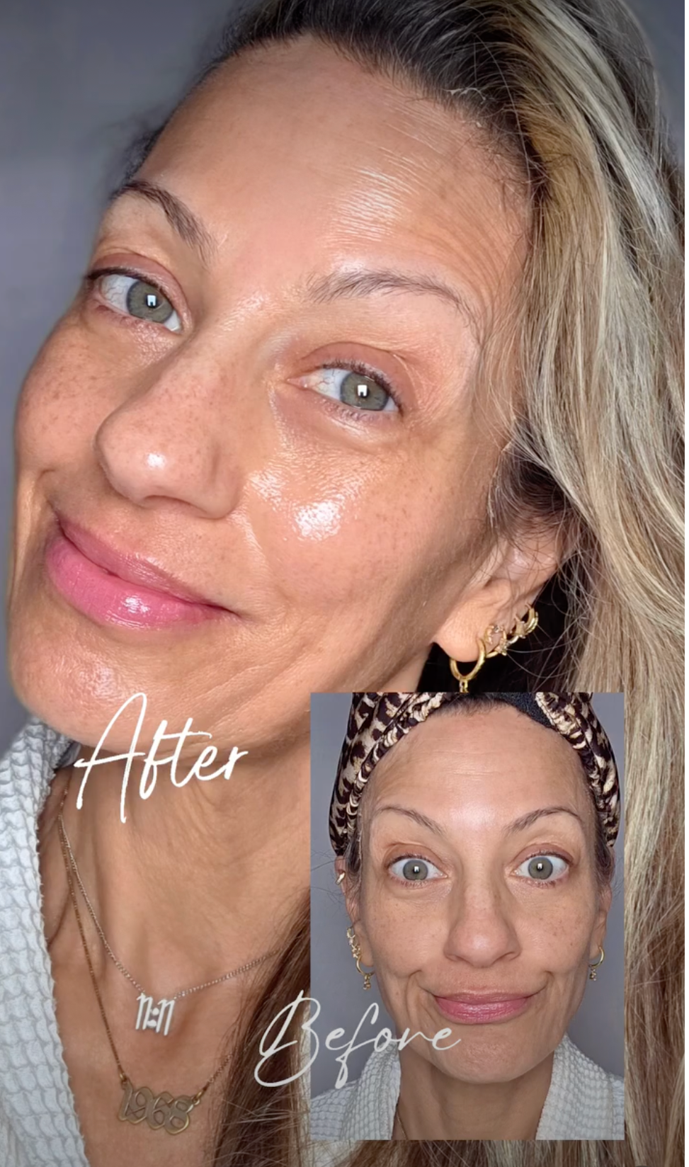 Why Women Love the Bluile 3D Lifting Mask