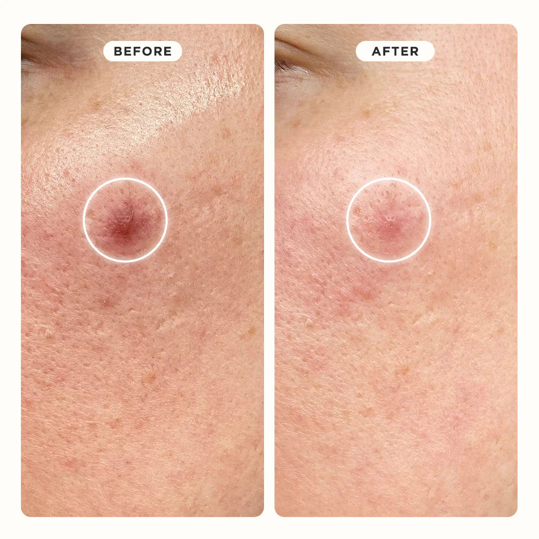 before after 2